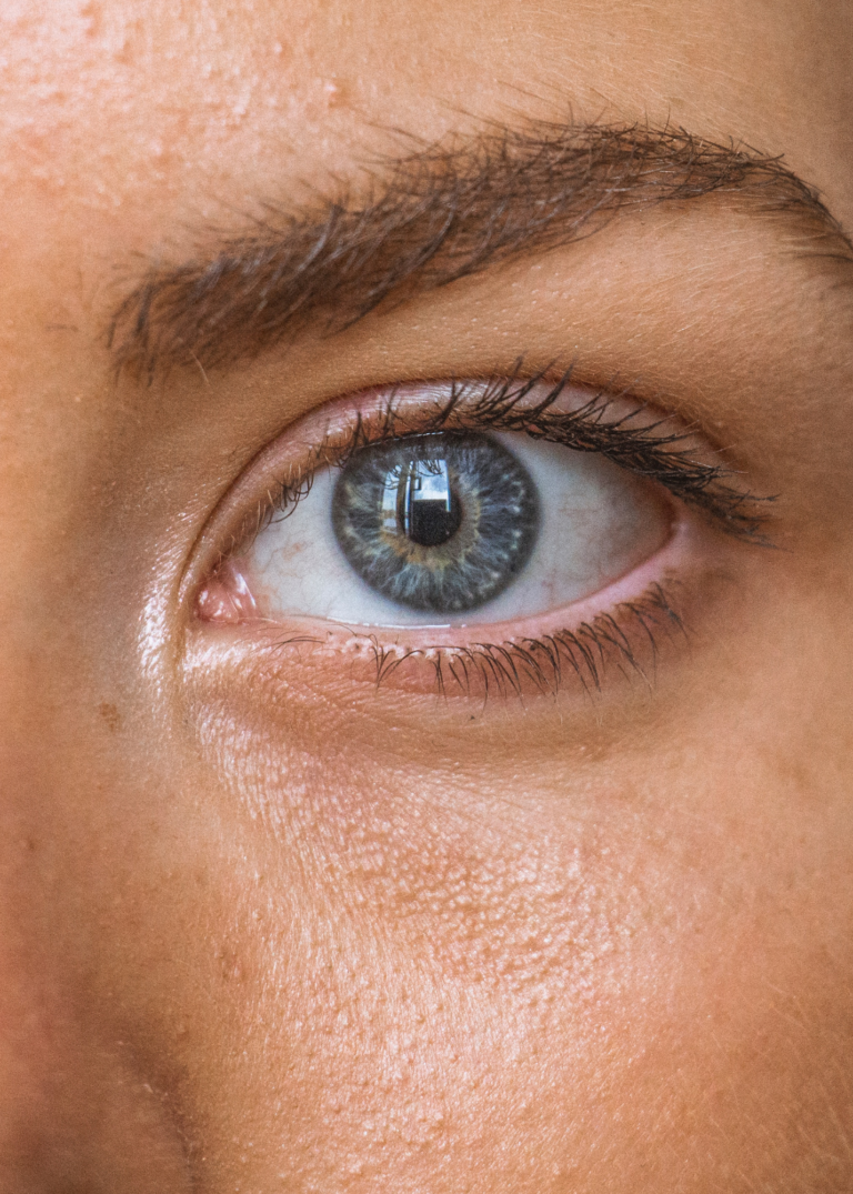 The Best Remedies for Dark Under-eye Circles